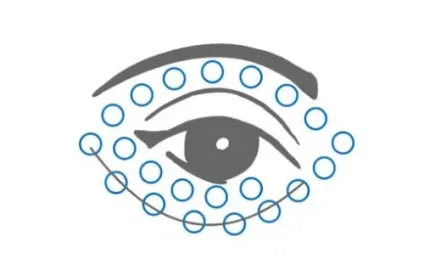 Вакуумний масаж обличчя як робиться апаратом і банками відгуки та відео (вакуумний) Вакуумний масаж обличчя як робиться апаратом і банками відгуки та відео