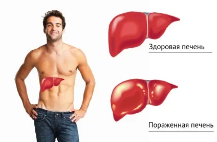 Вакцини проти гепатиту імпортні, вітчизняні (проти) Вакцини проти гепатиту імпортні, вітчизняні