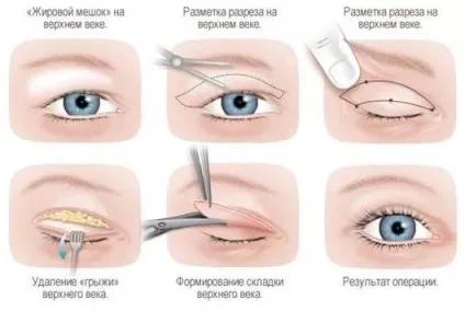 Догляд за століттями