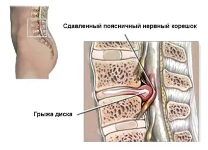 Узі хребта що показує