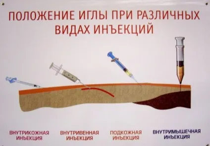 види ін'єкцій