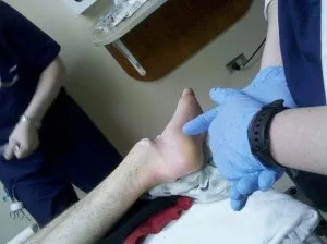 Вивих стопи симптоми і лікування що робити при підтаранний вивиху стопи