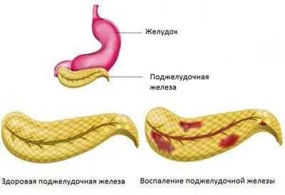 Вплив алкоголю на жіночий організм і репродуктивну систему жінки (репродуктивну) Вплив алкоголю на жіночий організм і репродуктивну систему жінки
