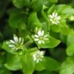 Водянка - що це за хвороба види, причини, лікування, сімейний сайт (лікування) Водянка - що це за хвороба види, причини, лікування, сімейний сайт