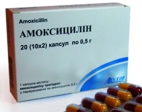 Запалення мигдалин лікування в домашніх умовах опухлих гланд (домашніх) Запалення мигдалин лікування в домашніх умовах опухлих гланд