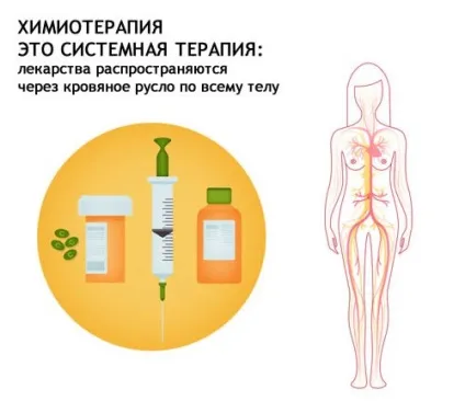 Хіміотерапія при раку молочної залози (залози) Хіміотерапія при раку молочної залози