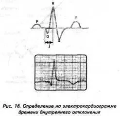 Зудбінов ю