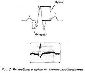 Зудбінов ю