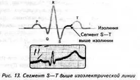 Зудбінов ю