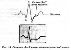 Зудбінов ю