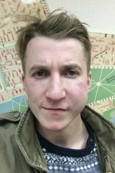 Зірку «інтернів» Дмитро Шаракоіс жорстоко побили () Зірку «інтернів» Дмитро Шаракоіс жорстоко побили