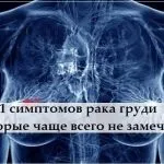 5 П'ять поширених видів раку і їх симптоми (поширених) 5 П'ять поширених видів раку і їх симптоми