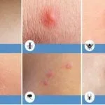 5 П'ять поширених видів раку і їх симптоми (поширених) 5 П'ять поширених видів раку і їх симптоми