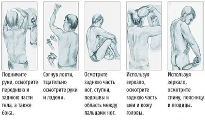 5 П'ять поширених видів раку і їх симптоми (самих) 5 П'ять поширених видів раку і їх симптоми