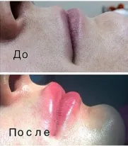 Амд лабораторії Бердянськ - сторінка 2 з 2 - лікування волосся, прийом трихолога, лікування алопеції, (волосистої частини голови) Амд лабораторії Бердянськ - сторінка 2 з 2 - лікування волосся, прийом трихолога, лікування алопеції,