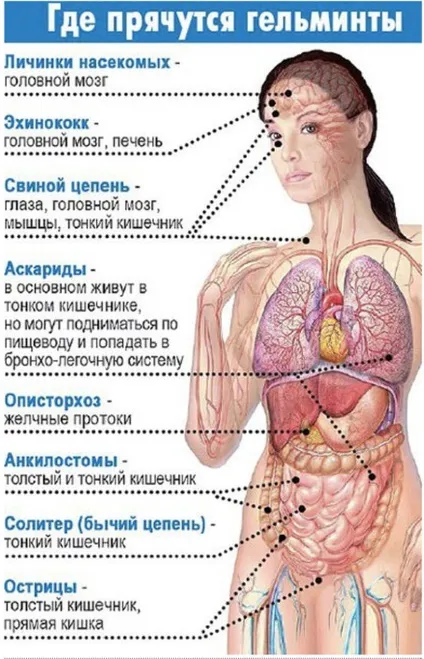 Антипаразитарний очищення - особистий досвід