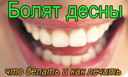 Болять ясна - що робити, лікування в домашніх умовах (розчином фолієвої кислоти) Болять ясна - що робити, лікування в домашніх умовах