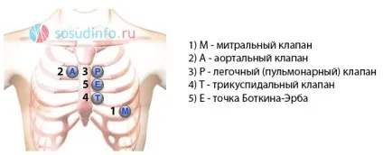 Аускультація серця (вислуховування) точки, алгоритм, суть (вислуховування) Аускультація серця (вислуховування) точки, алгоритм, суть