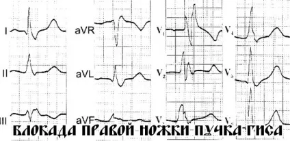 Аускультація серця точки вислуховування (аускультація) Аускультація серця точки вислуховування