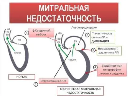Аускультація серця точки вислуховування (точки) Аускультація серця точки вислуховування