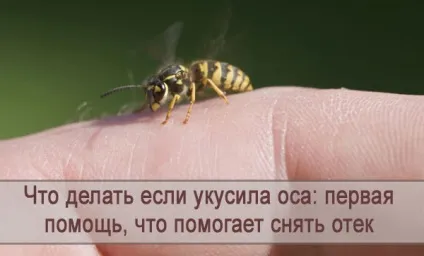 Що робити якщо вкусила оса перша допомога, що допомагає зняти набряк (робити) Що робити якщо вкусила оса перша допомога, що допомагає зняти набряк