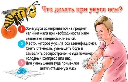 Що робити якщо вкусила оса перша допомога, що допомагає зняти набряк (допомога) Що робити якщо вкусила оса перша допомога, що допомагає зняти набряк