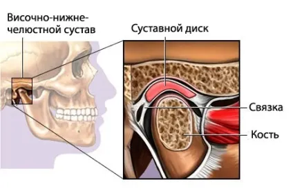 Що показує мрт скронево-нижньощелепного суглоба і показання (скронево-нижньощелепного) Що показує мрт скронево-нижньощелепного суглоба і свідчення