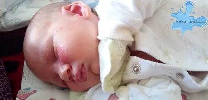 Цвітіння новонароджених симптоми, догляд, скільки триває (симптоми) Цвітіння новонароджених симптоми, догляд, скільки триває