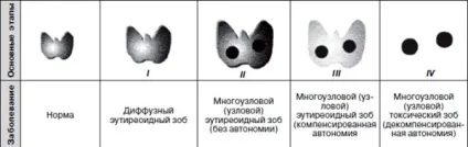 Дисбаланс гормонів у жінок