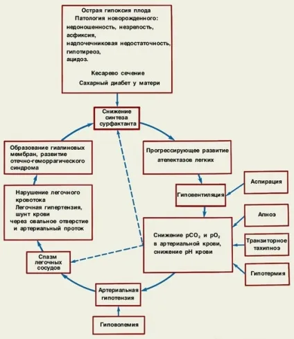 Дистрес-синдром респіраторний новонароджених - це (дистрес-синдром) Дистрес-синдром респіраторний новонароджених - це