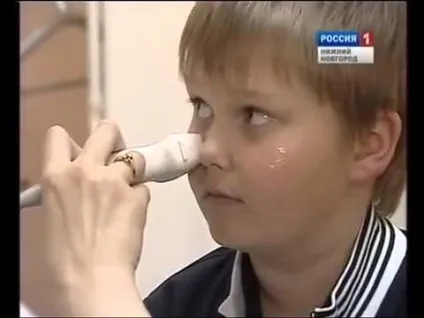 Двосторонній синусит симптоми і лікування, заходи профілактики (двосторонній) Двосторонній синусит симптоми і лікування, заходи профілактики