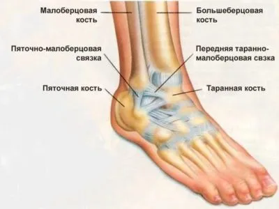 Ендопротезування гомілковостопного суглоба 1 (гомілковостопного) Ендопротезування гомілковостопного суглоба 1