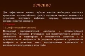 Глибокі мікози види захворювання, симптоми, лікування (захворювання) Глибокі мікози види захворювання, симптоми, лікування