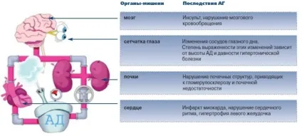 Гіпертонічний криз симптоми, лікування, невідкладна допомога хворому (криз) Гіпертонічний криз симптоми, лікування, невідкладна допомога хворому