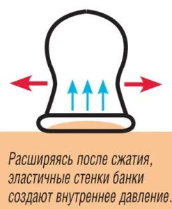 Гірчичники і банки при бронхіті і пневмонії чи можна ставити, як це робити, протипоказання, (болі розсмоктування запальних) Гірчичники і банки при бронхіті і пневмонії чи можна ставити, як це робити, протипоказання,