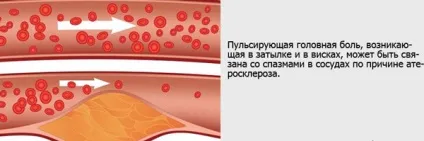 Головний біль в потилиці (потиличної частини) - причини, що робити, лікування (частини) Головний біль в потилиці (потиличної частини) - причини, що робити, лікування