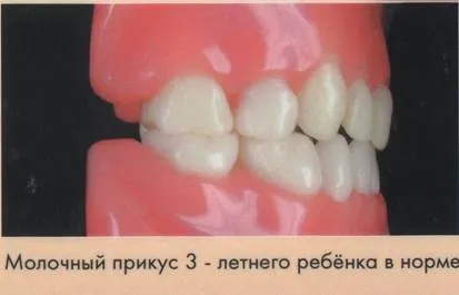 Ідеальний прикус - яким він повинен бути, діагностика (прикус) Ідеальний прикус - яким він повинен бути, діагностика