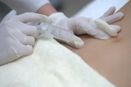 Ін'єкції для схуднення живота, чи можна їх робити в домашніх умовах (домашніх) Ін'єкції для схуднення живота, чи можна їх робити в домашніх умовах