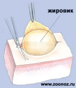 Які мазі від жировик (ліпоми) найбільш ефективні (ліпоми) Які мазі від жировик (ліпоми) найбільш ефективні