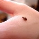 Як лікувати укуси клопів ніж мазати, ліки від клопів, фото і відео (лікувати) Як лікувати укуси клопів ніж мазати, ліки від клопів, фото і відео