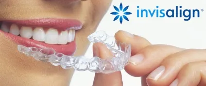 Брекети invisalign (сша) - ефективні і невидимі для оточуючих (оточуючих) Брекети invisalign (сша) - ефективні і невидимі для оточуючих