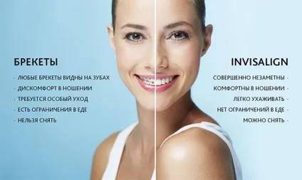 Брекети invisalign (сша) - ефективні і невидимі для оточуючих (invisalign) Брекети invisalign (сша) - ефективні і невидимі для оточуючих