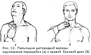 Як намацати щитовидну залозу (щитовидна залоза) Як намацати щитовидну залозу
