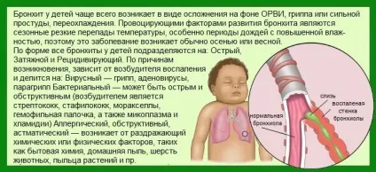 Бронхіт у грудничка