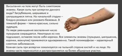 Як виглядає висип