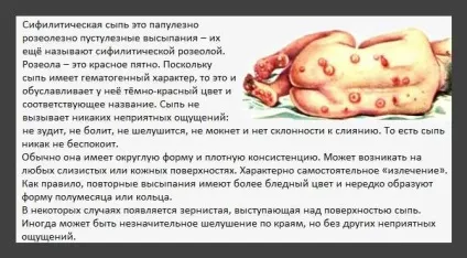 Як виглядає висип