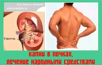 Як виростити каркаде в домашніх умовах - китайська троянда догляд і розкішні фото в домашніх умовах (виростити) Як виростити каркаде в домашніх умовах - китайська троянда догляд і розкішні фото в домашніх умовах