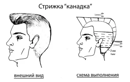 Канадка поради для тих, хто вирішив зробити цю стрижку (Чоловіча стрижка канадка) Канадка поради для тих, хто вирішив зробити цю стрижку
