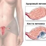 Климадинон інструкція із застосування, ціна, відгуки, аналоги (Лікарський препарат Климадинон) Климадинон інструкція із застосування, ціна, відгуки, аналоги