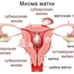Климадинон інструкція із застосування, ціна, відгуки, аналоги (клімадінон) Климадинон інструкція із застосування, ціна, відгуки, аналоги